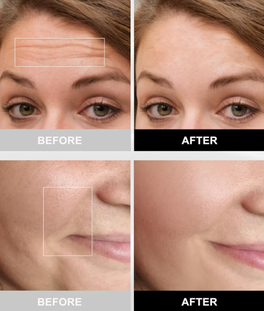 Radiant Glow LED Face Mask